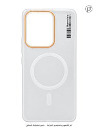 كفر SYNDEE سلم مطفي حماية كاميرا MagSafe مضاد للاصفرار لجهاز ريلمي 15 SYNDEE MagSafe Realme 15 Case