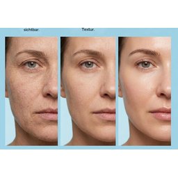 كريم مرطب هايلرونيك اسيد ماروديرم Maruderm Hyaluronic Acid Moisturizer Cream
