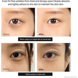 دكتور ميلاكسين كريم مصحح لمنطقة العينين DR.MELAXIN Calcium Dark Spot Cover Eye Cream 15g