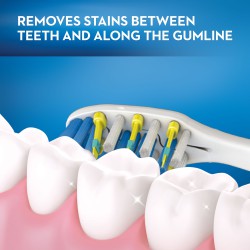 فرشاة اسنان تعمل بالبطارية Soft Pulsar 3D White Whitening Therapy Toothbrush