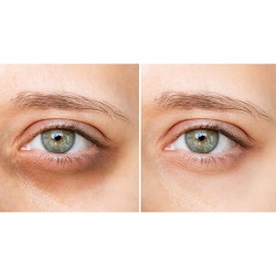 كونسيلر ومصحح لون Concealer Correcting Care