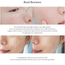ايسنس لتهدئة البشرة 30 مل Skin Relief Essence 30 ml