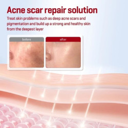 تونر الحلزون لاصلاح البشرة 150 مل Snail Truecica Miracle Repair Toner 150ml