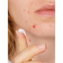 كريم عناية مركزة للبشرة لمقاومة الشوائب 15 مل Intensive Care Anti-Imperfections Cream 15ml