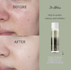 تونر اناستاتيكا لترطيب وتهدئة البشرة Anastatica Skin Conditioning Toner