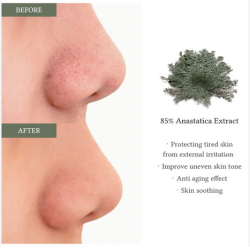 تونر اناستاتيكا لترطيب وتهدئة البشرة Anastatica Skin Conditioning Toner