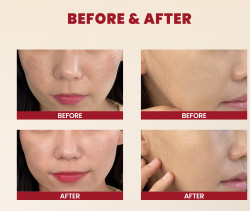 اسنس الحلزون والأرز المكثف SEOUL 1988 Essence : Snail Mucin 97% + Rice