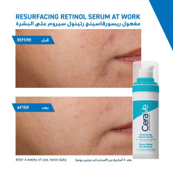 رتينول سيروم يُخفّف مظهر المسام و آثار الحبوب 30 مل Resurfacing Retinol Serum for Post-Acne Marks 30ml