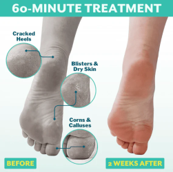 بكج العناية بالقدم Foot Care Package