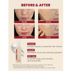 سيول 1988 إيسنس الوجه بمستخلص الحلزون 97% والأرز Seoul 1988 Snail Mucin 97% & Rice Essence Face