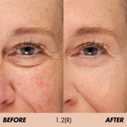 كونسيلر HD سكن للبشرة HD Skin Concealer
