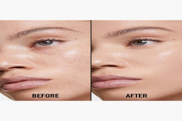 كونسيلر فوريڤر سكين كوريكت Forever Skin Correct Concealer