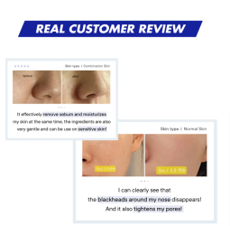 جل كريم للتقليل من الرؤوس السوداء وتنعيم المسام MORE BLACKHEAD PORE GEL CREAM