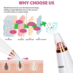 جهاز تنظيف المسام وإزالة الرؤوس السوداء الكهربائي Electric Blackhead Remover Vacuum
