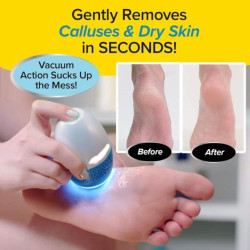 جهاز إزالة الجلد الميت وتشقق القدمين مع شفط وفلتر Rechargeable Callus Remover with Vacuum & LED Light