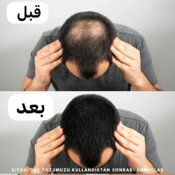 بودره لتعبئة فراغات الشعر Folixen