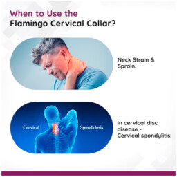 طوق عنق طبي (دعامة الرقبة) Cervical Collar