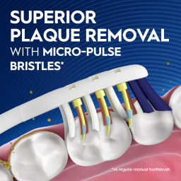 فرشاة أسنان يدوية اورال-بي برو إكسبرت بولسار تعمل بالبطارية Oral-B Pro-Expert Pulsar Battery Powered Toothbrush