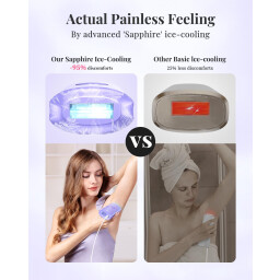جهاز إزالة الشعر IPL سافير الياقوت بتبريد احترافي منزلي Sapphire IPL Hair Removal Device with Professional Cooling for Home Use