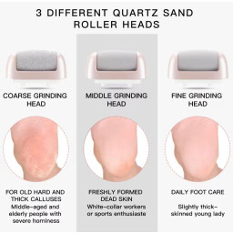 جهاز تنعيم القدم الكهربائي Callus Remover