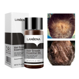 سيروم عناية بالشعر للتحكم بالزيوت 20 مل Oil Control Hair Care Serum 20ml