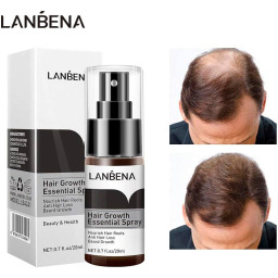سيروم نمو الشعر 20 مل مضاد لتساقط الشعر للجنسين Hair Growth Essence 20ml Anti Hair Loss – For Unisex