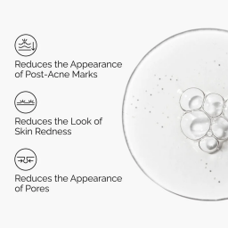 سيروم الألوفيرا 2% + NAG 2% – لعلاج الحبوب وآثارها وتهدئة البشرة Aloe 2% + NAG 2% Solution – Acne Care & Skin Soothing Serum