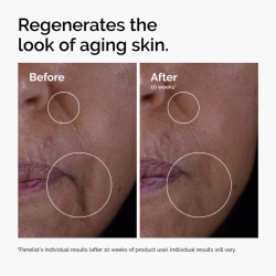 سيروم عوامل النمو 15% لتجديد البشرة وتقليل التجاعيد GF 15% Solution Anti-Aging Serum