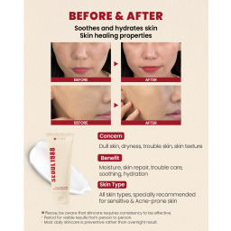 كريم الحلزون والأرز 93٪ للبشرة الحساسة Snail Mucin 93% Facial Cream  For Sensitive Skin