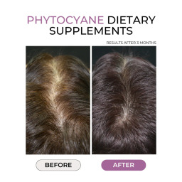 كبسولات ضد تساقط الشعر، 84 كبسولة Anti Hair Loss Capsules - 84 Capsules