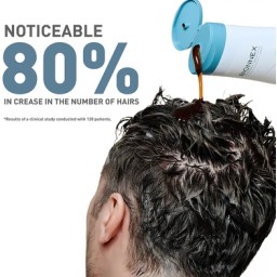 بايونكس اوركانيكا شامبو ضد التساقط للشعر العادي 300مل Bionnex Organica Anti Hair Loss Shampoo - Normal Hair 300ml