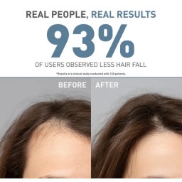 بايونكس اوركانيكا شامبو ضد التساقط للشعر العادي 300مل Bionnex Organica Anti Hair Loss Shampoo - Normal Hair 300ml