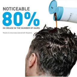 بايونكس اوركانيكا شامبو ضد تساقط الشعر وضدالقشرة Bionnex Organica Anti Hair Loss Shampoo - Dandruff Control 300ml