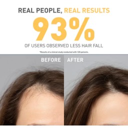 بايونكس اوركانيكا شامبو ضد التساقط للشعر الجاف والمتضرر 300 مل Bionnex Organica Anti Hair Loss Sahmpoo - Dry and Damaged Hair 300 ml