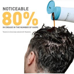 بايونكس اوركانيكا شامبو ضد التساقط للشعر الجاف والمتضرر 300 مل Bionnex Organica Anti Hair Loss Sahmpoo - Dry and Damaged Hair 300 ml