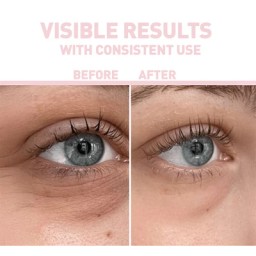 بايونكس كافيين سيرم للهالات السوداء 30 مل Bionnex The Nordea Brightening Caffeine Serum For The Eye Area 30 ml