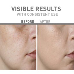 بايونكس وايت اكسبرت كريم للهالات السوداء حول العين 15 مل Bionnex Whitexpert Eye Contour Cream 15ml