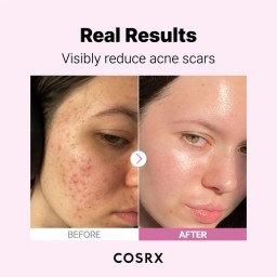 COSRX The Niacinamide 15 Serum سيروم النياسيناميد من كوزركس