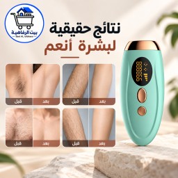 جهاز ليزر منزلي الثلجي لايت بلص من ليزر رفاهية ipl + هدية مجفف شعر عالي الجودة (هدية) .The IPL rafahea laser IPL Ice Light Plus Home Laser Device + هدية مجفف شعر عالي الجودة (Gift)