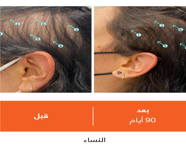 بلسم ريفيتا REVITA HIGH-PERFORMANCE HAIR DENSITY CONDITIONER