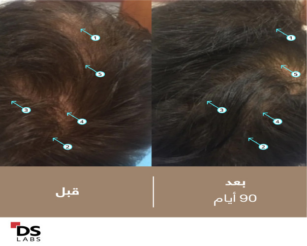 البخاخ الرجال للكثافة الشعر بالنانوكسيديل 5% Spectral Men's (DNC-N) Hair Density Serum with Nanoxidil® 5%
