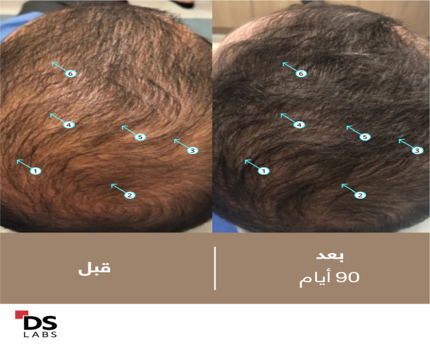 البخاخ الرجال للكثافة الشعر بالنانوكسيديل 5% Spectral Men's (DNC-N) Hair Density Serum with Nanoxidil® 5%