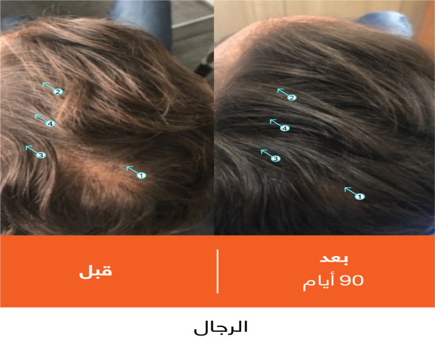 شامبو ريفيتا عالي الأداء لكثافة الشعر Revita High-Performance Hair DENSITY Shampoo