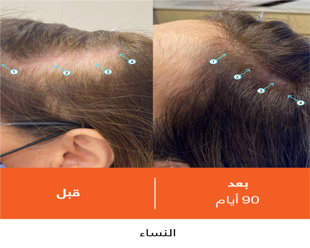شامبو ريفيتا عالي الأداء لكثافة الشعر Revita High-Performance Hair DENSITY Shampoo