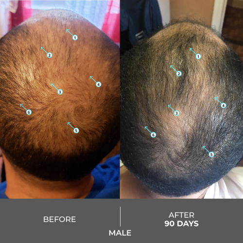 شامبو ريفيتا اكسترا للرجال والنساء الذين يعانون من تساقط الشعر Revita Extra Strength Hair DENSITY Shampoo