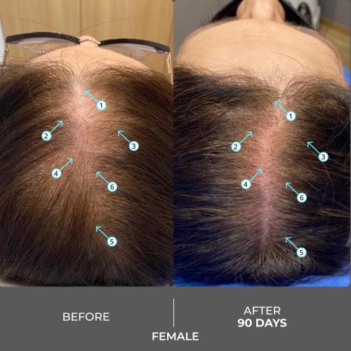 شامبو ريفيتا اكسترا للرجال والنساء الذين يعانون من تساقط الشعر Revita Extra Strength Hair DENSITY Shampoo